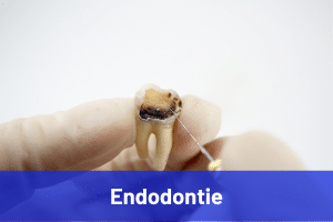 Spécialité dentiste omnipratique : endodontie
