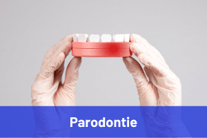 Image parodontie